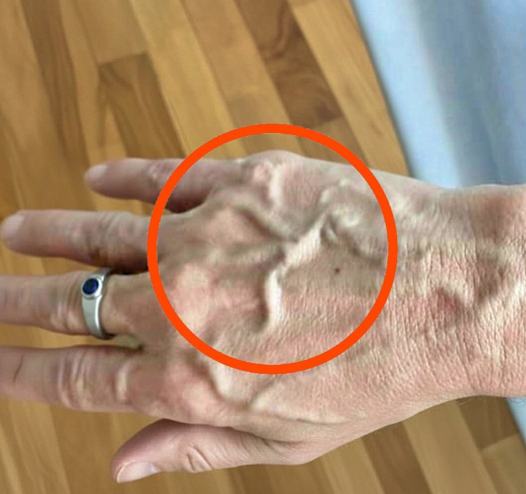If you have visible veins it means you are…
